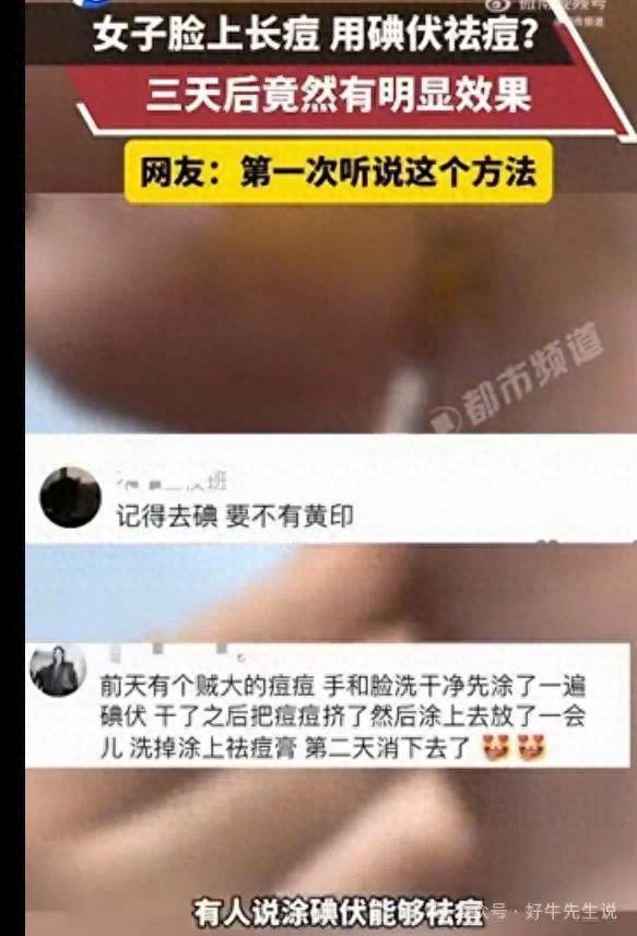 涂抹碘伏祛痘3天就见效？惊呆女大学生！皮肤科专家：可以但没必要-1.jpg